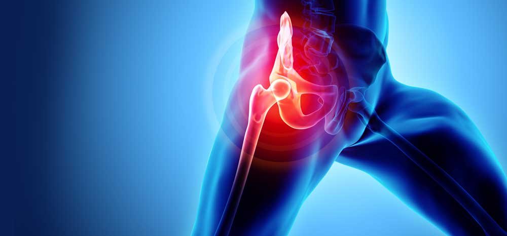 AVN treatment in Jabalpur