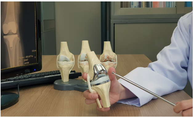 Knee replacement in Bhopal