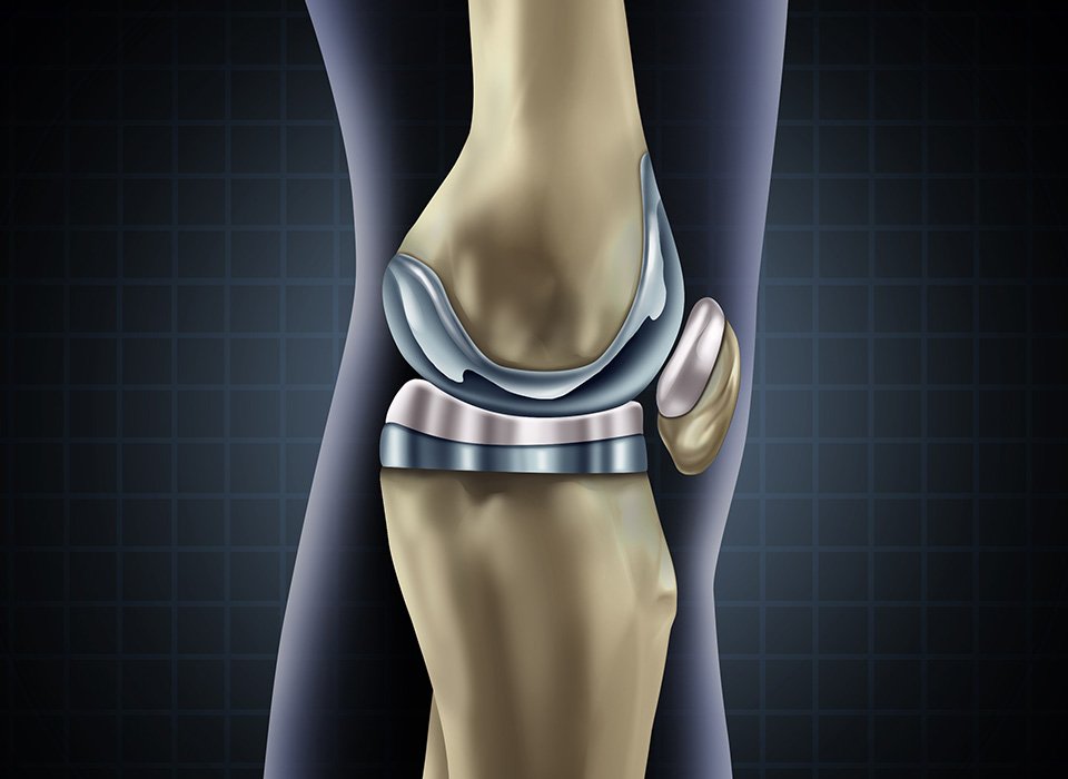 Joint Replacement Surgery Specialist In Satna