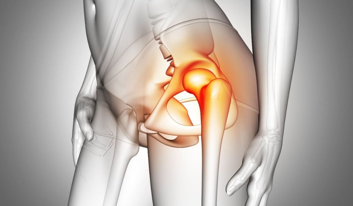 Complex knee replacement In Nagpur