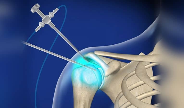 Arthroscopic surgery specialist in rewa