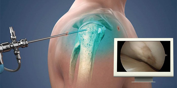 Arthroscopic surgery specialist in satna