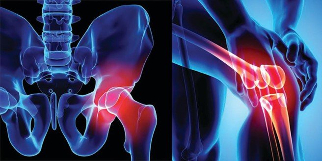 Best hip replacement doctor In Nagpur