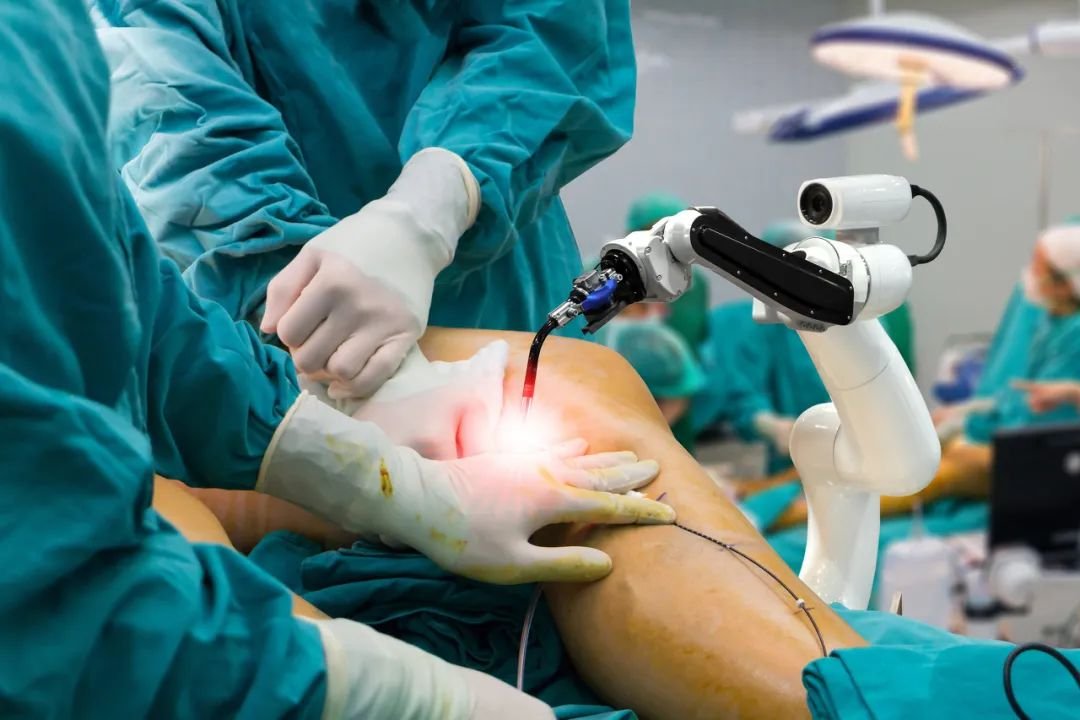 Robotic knee replacement in Rewa