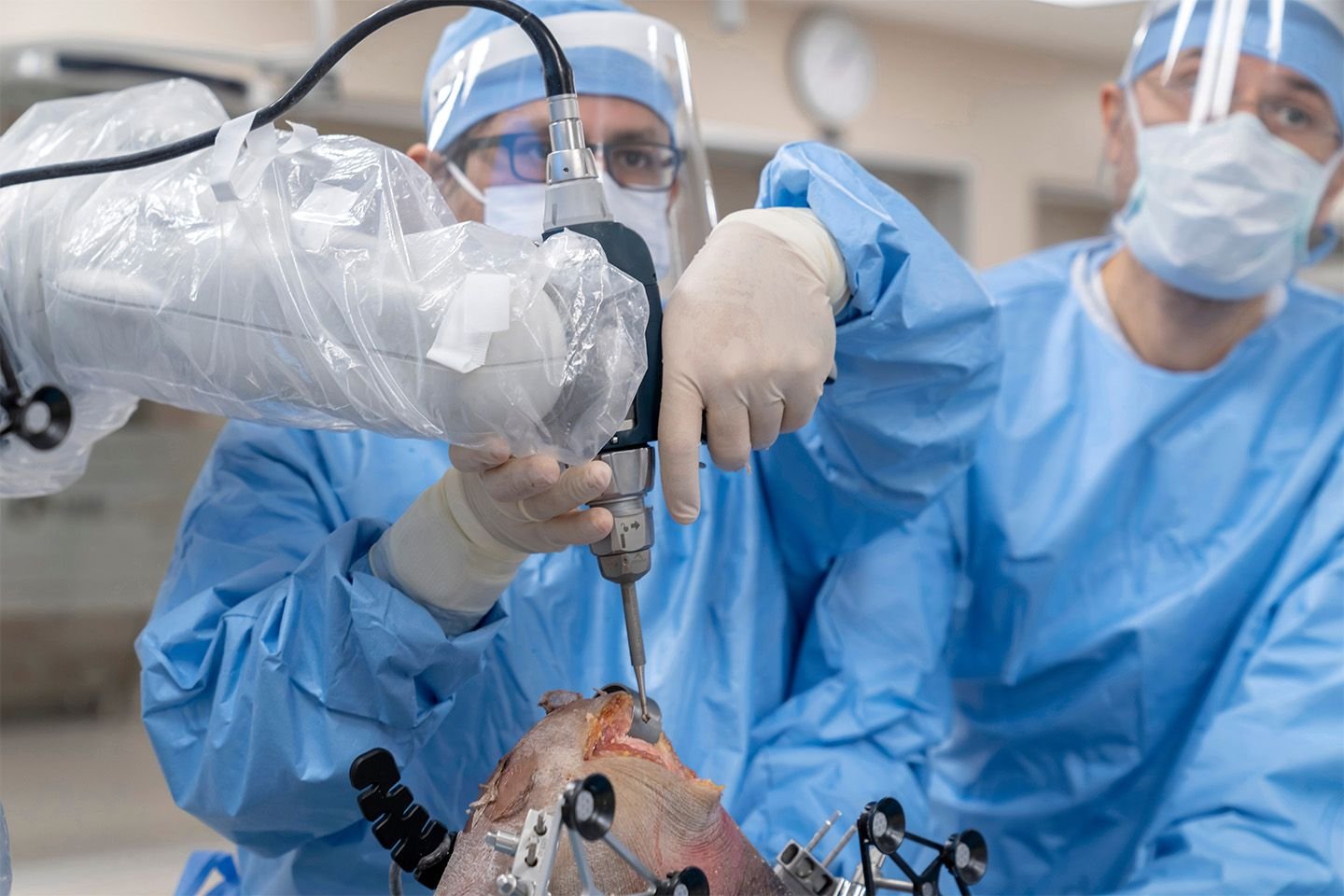 Robotic knee replacement in satna