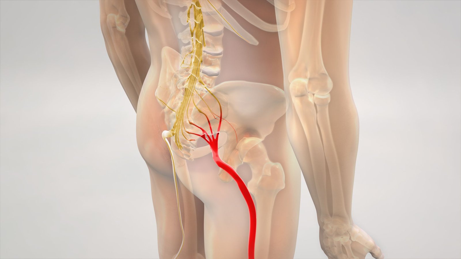 Sciatica surgery Specialist In Nagpur