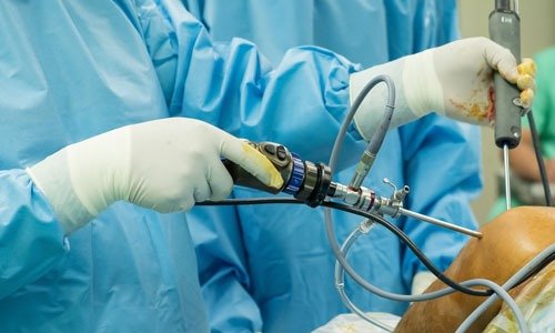 Shoulder arthroscopy in Satna