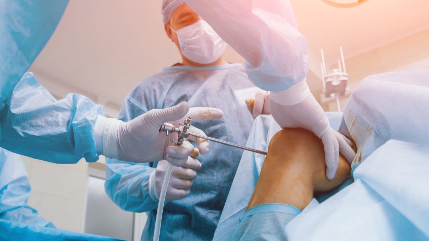 Sports injury arthroscopy In rewa