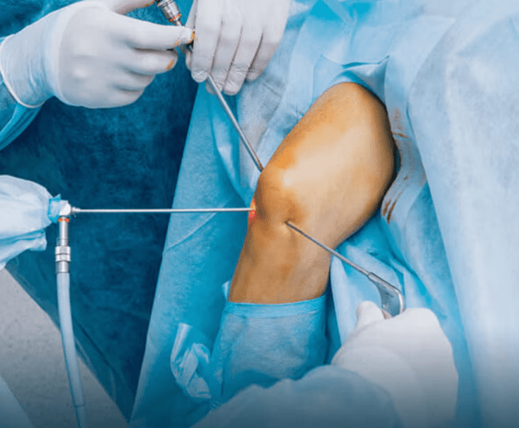 Sports injury arthroscopy In satna
