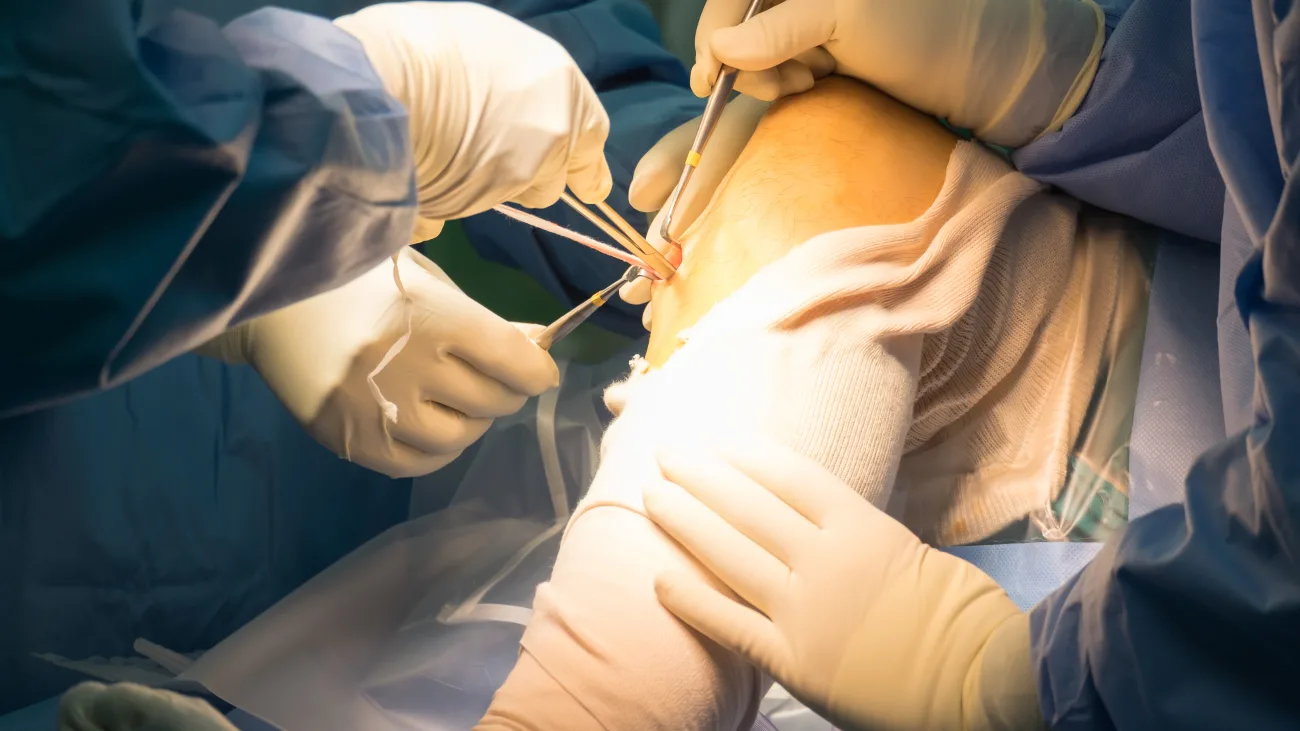 ACL reconstruction surgery specialist in Seoni