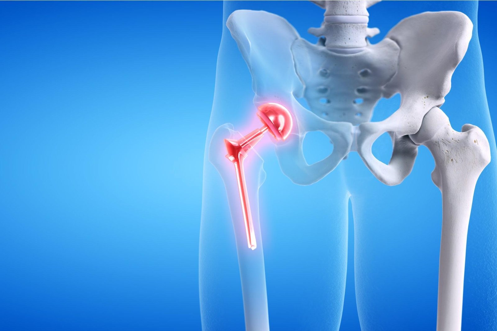 Joint replacement surgery specialist in Itarsi