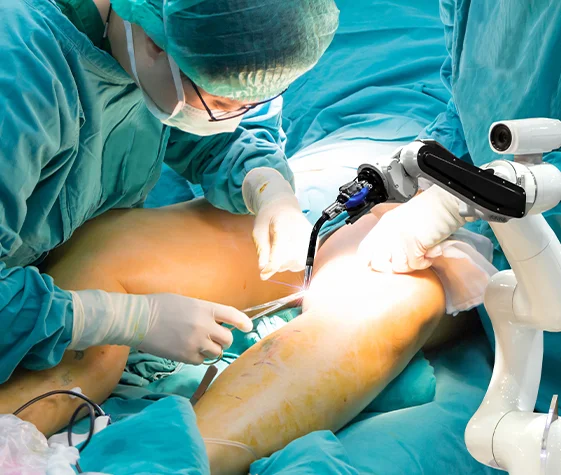 Limb reconstruction surgery specialist in Betul