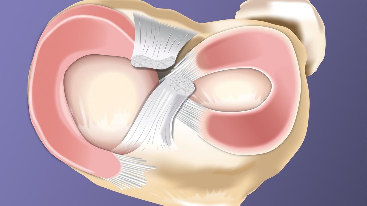 Meniscus repair surgery specialist in Mandla