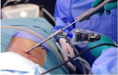 Slipped disc surgery Specialist In Itarsi