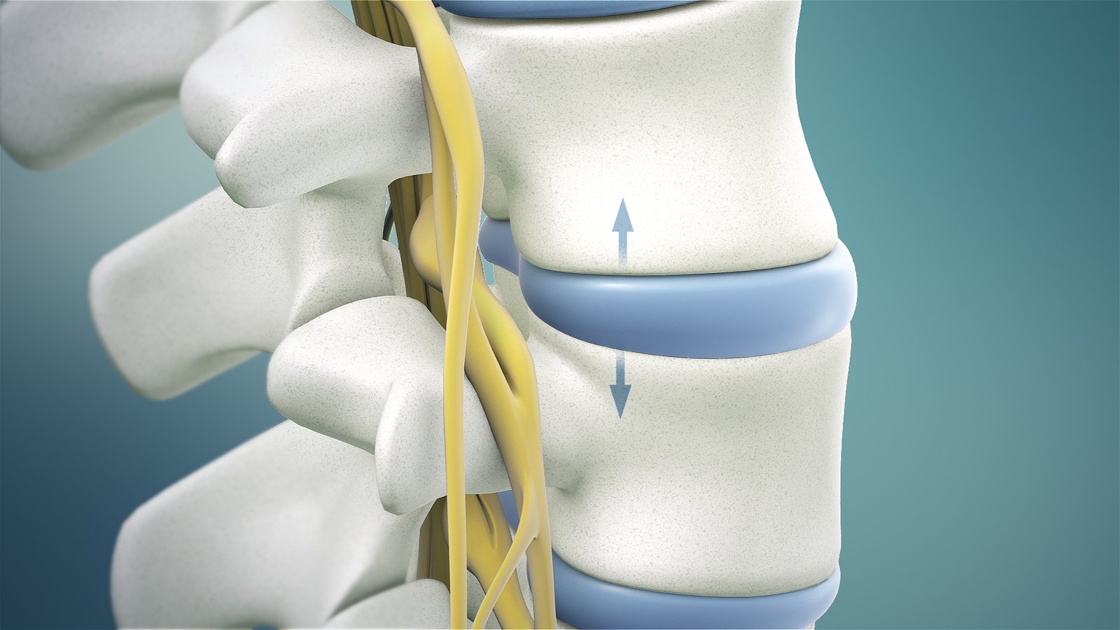 Spinal cord decompression In Mandla