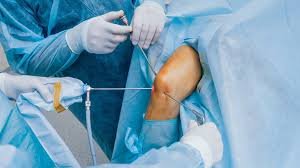 Arthroscopic surgery specialist in Chhindwara