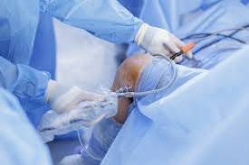 Arthroscopic surgery specialist in Seoni