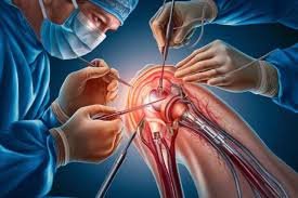 Best knee replacement surgeon in Seoni