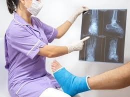 Fracture surgery specialist in Chhindwara