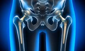 Hip revision specialist in Harda