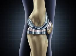 Knee replacement surgery Specialist in Hoshangabad