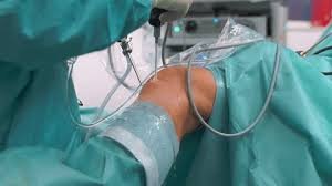 Knee revision surgeon in Harda