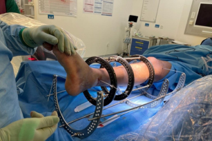 Limb reconstruction surgery specialist in Harda