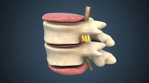Spinal cord decompression in Harda