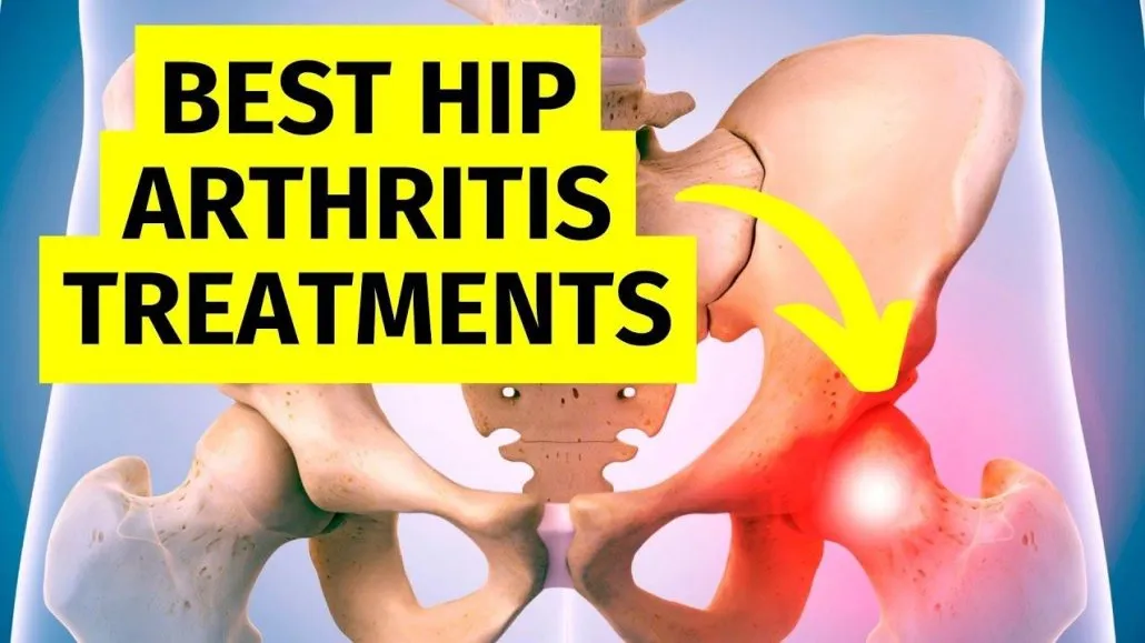 hip arthritis surgery specialist in adilabad