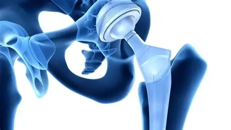 hip revision specialist in adilabad