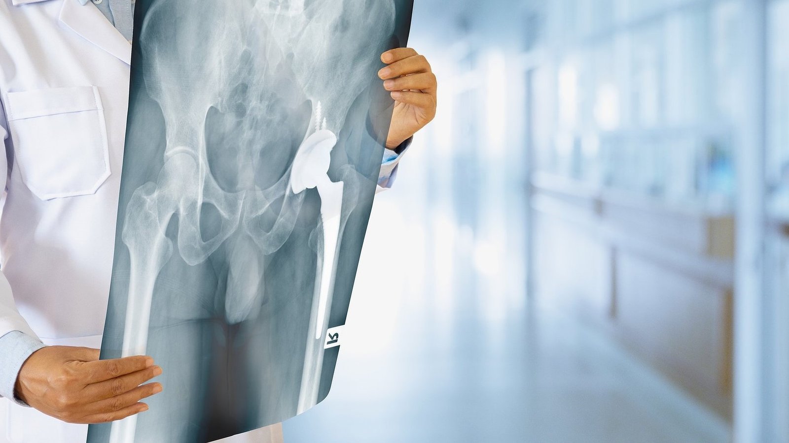 joint replacement surgery specialist